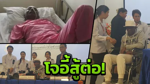 โจอี้ บาซู อาการดีขึ้น แต่ผลกระทบเส้นเลือดสมอง ทำบางอย่างไม่เหมือนเดิม