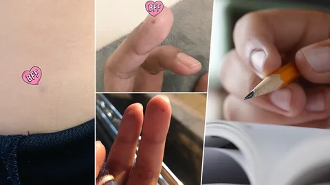 เรารู้คุณก็มี! แห่แชร์ภาพไส้ดินสอฝังใน จุดสีดำเล็กๆ ใครไม่มีนับว่าเชย