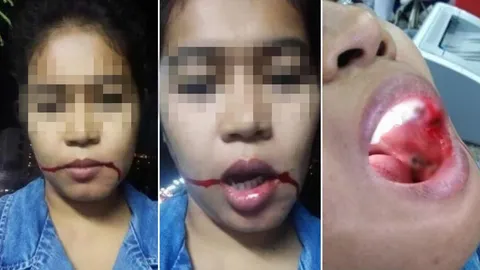 กร่าง! หนุ่มขับแท็กซี่ต่อยปากสาวเจ็บ บอกจำได้ว่าเคยแชร์คลิปท้าตีแกร็บ