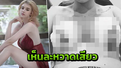 เจสซี่ วาร์ด โชว์ภาพหวาดเสียว เผยเหตุผลที่แก้นม 