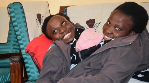 เศร้า แฝดสยามแทนซาเนีย เสียชีวิตแล้ว วัย 21 ปี