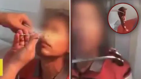 อะไรอยู่ในจมูก? หนุ่มผงะ หมอคีบออกมาตัวเป็นๆ ต้นเหตุทำเลือดไหลไม่หยุด