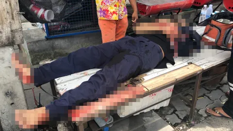 เจ็บแขนไม่เท่าเจ็บใจ! หนุ่ม 21 ทะเลาะกับแฟนต่อยกระจกบาดแขนสาหัส 