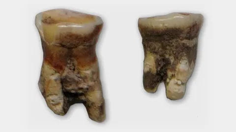 ฟันโบราณชี้บรรพบุรุษยุคหินกลาง กินปลาและพืช