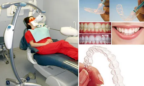 เมื่อฟันเปลี่ยนสี กับ หลากวิธีฟอกสีฟัน