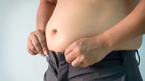 เลือก! ลดพุงหรือตกงาน