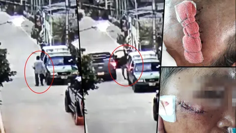 ล่าหนุ่มบางปู จอดรถตื้บคนแก่ บาดเจ็บต้องเย็บแผลบนโหนกแก้มและศีรษะ (คลิป)