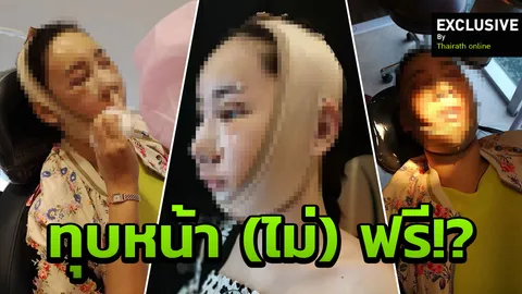 ไปศัลยกรรมเกาหลี พังกันมาเยอะแล้ว นางงามดัง เตือนภัย! 