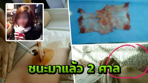 ลุ้นฎีกาคดีประวัติศาสตร์! สาวไทยฟ้องหมอเกาหลี อัพดั้งลืมผ้าก๊อซ จ่อเรียก 10 ล้าน