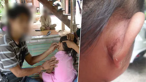 พ่อสุดทน! เอาเรื่องครูทำโทษโหด บิดหูลูก 4 ขวบช้ำ กลัวจนไม่กล้าไปเรียน