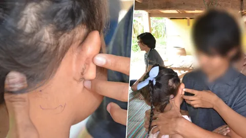 ขอย้ายโรงเรียน! พ่อเผยลูกสาว 4 ขวบยังหวาดกลัว หลังครูสารภาพบิดหูจริง