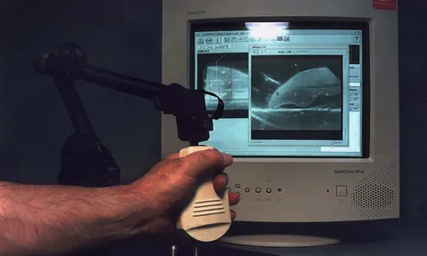 พัฒนาวิธีตรวจสอบมะเร็งปากมดลูก รู้ล่วงหน้าเป็นปี