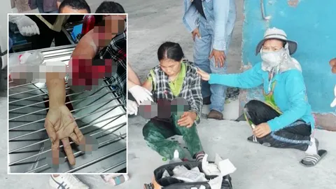 คนงานสาวกัมพูชา โดนเครื่องสายพานหนีบแขนขาดสยอง คาโรงงานที่ศรีราชา 