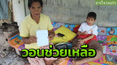 สาวท้าวแสนปม วอนช่วยลูกชายป่วยประหลาด ขาบวม บ้านไม่มีไฟฟ้าใช้