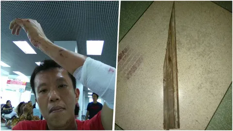 'เอกชัย หงส์กังวาน' FB ถูกชายฉกรรจ์รุมตี เจ็บเลือดอาบ