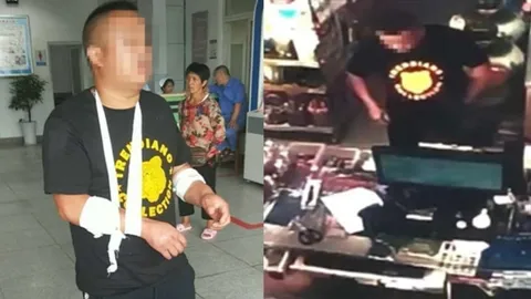 หนุ่มแอ๊บรวยเข้าตาจน! ไม่มีเงินซื้อรถให้แฟน กรีดแขนตัวเองอ้างโดนปล้น