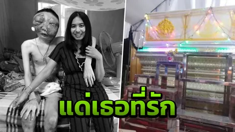 ใจสลาย... แฟนสาว โพสต์ถึง 'โพ' หนุ่มป่วยมะเร็งตา คิดถึงเท่าไรก็คงไม่ได้เจอ