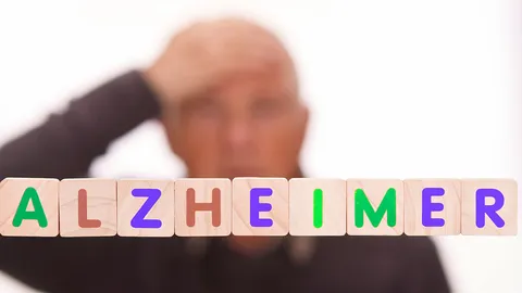 ตรวจตาอย่างง่ายอาจช่วยทำนายโรคอัลไซเมอร์