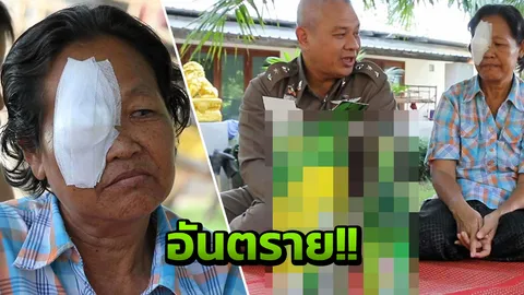 'ยายแงง' ตาติดเชื้อรุนแรง แพทย์เตือน ยากิน-ยาหยอด ตัวเดียวกันไม่ได้