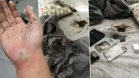 ไม่คิดว่าจะเจอกับตัว...หนุ่มชาร์จมือถือทิ้งไว้ตอนนอน แบตระเบิดกลางดึก!