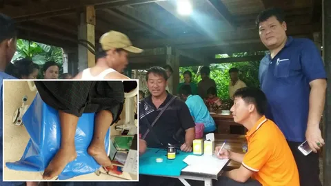 โรคเท้าช้างคืนชีพ! คนตากตื่นหลัง รพ.แม่สอด พบหนุ่มเมียนมาป่วยจริง