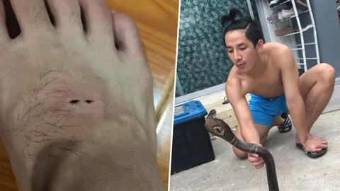 เรื่องนี้มันยังไง! คนเลี้ยงงูพิษ โชว์แผลที่เท้า บอกนี่คือผลของความประมาท