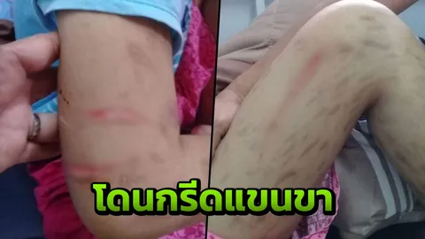 ฝีมือเด็ก 12? พลเมืองดีแจ้งตำรวจช่วยเด็กตาบอด ฝากเลี้ยงกลับถูกกรีดทั้งตัว