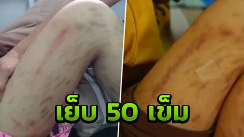 โมโหไม่กินข้าว! เด็กชาย 12 ยอมรับใช้มีดกรีดแขนเด็กสาวตาบอดจริง