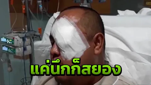 ไม้ไผ่เสียบตาสยอง โผล่เกินท้ายรถกระบะ ขบวนปั่นจักรยานชนเต็มๆ