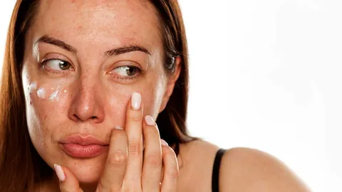 ฝ้า กระ แก้ไม่หาย หรือแก้ผิดจุด