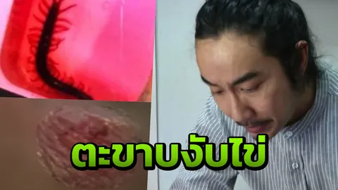 มายังไง! ตะขาบเลื้อยเข้ากางเกงขาเดฟ กัดอวัยวะเพศหนุ่มกลางห้างดัง (คลิป)