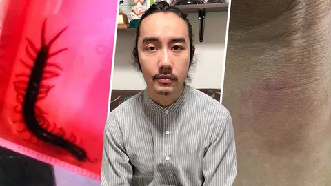 อจ.ยันตะขาบไม่ได้ติดตัวมา นั่งติวตั้ง4ชม.ทำไมเพิ่งจะกัด ห้างชี้สุดวิสัย!