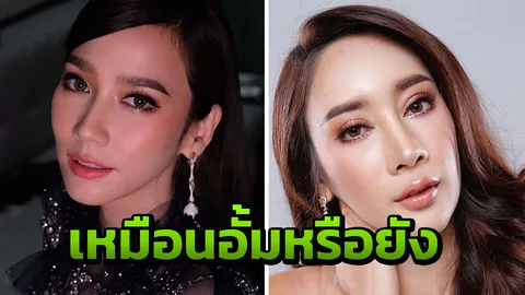 น้ำเพชร ถามเหมือน อั้ม พัชราภา หรือยัง หลังทำศัลยกรรมผ่านมา 3 เดือน