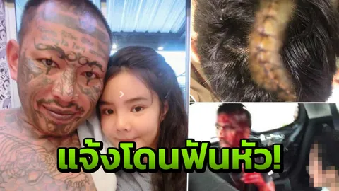 แจ้ง‘น้องเนย’เมีย‘เก่ง ลายพราง’ชวนไปห้อง เจอแฟนใหม่ฟันสาหัส 