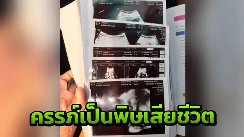 ลูกรอดแต่เสียภรรยา! หนุ่มข้องใจหมอคลินิกบอกอาการปกติ สุดท้ายครรภ์เป็นพิษ