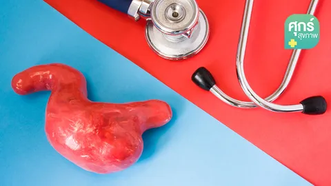 ปวดท้องแบบไหนที่เรียกว่า “ปวดท้องโรคกระเพาะอาหาร” (ตอน 2)