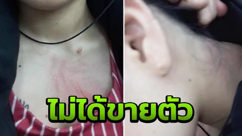 สาวไทยอ้างถูกทำร้าย หลังช่วยห้ามชายเกาหลีเมาพยายามปล้ำหมอนวด