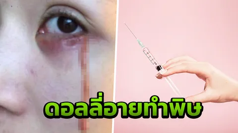 ตาเกือบบอด! อุทาหรณ์สาวฉีดดอลลี่อาย สุดท้ายอักเสบ ซ้ำรักษาหายขาดไม่ได้
