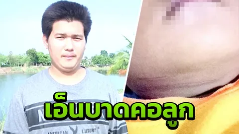 ร้องลั่นถนน! หนูน้อยขวบเศษเคราะห์ร้าย โดนเอ็นขึงกลางถนน คอเป็นแผลลึก 