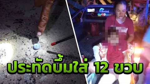 พ่อแม่ห้ามแล้วไม่ฟัง! ประทัดลูกบอล ระเบิดใส่ ด.ช.12 ขวบ มือฉีกเละ