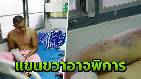 ได้ยินตะโกนสั่งรถให้เหยียบ หนุ่มช่างไฟเล่านาทีถูกตี เสียใจแขนอาจพิการ