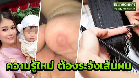 เป็นไปได้? เส้นผมคมกว่าที่คิด แทงเข้าผิวหนัง เสี่ยงติดเชื้อในกระแสเลือด