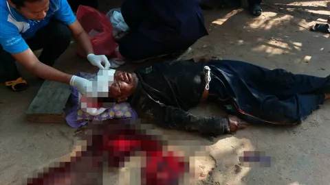 ลุงดวงแตก เติมลมยางรถไถเกินขนาด จนระเบิดน็อตกระเด็นโดนหัวแบะเจ็บสาหัส