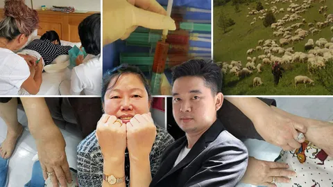 เซลล์บำบัดโรคร้าย ทางเลือกอยู่เยอรมนี