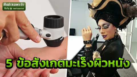 รู้จัก โรคมะเร็งผิวหนัง แสงแดด สารหนู สิ่งกระตุ้น จุดซ่อนเร้นก็เป็นได้