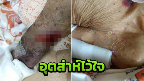 หลานโวยศูนย์ดูแลคนป่วย อ้างทำอาม่าวัย 91 แผลเต็มตัว ยันก่อนไปสภาพดี