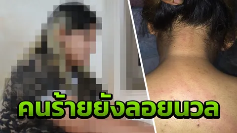 สาวตรังรอดข่มขืนช้ำ เจอภาวะแท้งคุกคาม ลูกโอกาสรอด50% จี้จับคนร้ายลงโทษ