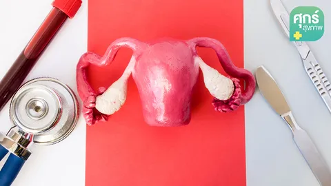 “เยื่อบุโพรงมดลูกเจริญผิดที่” เรื่องน่ารู้สำหรับผู้หญิงทุกคน (ตอน 2) 