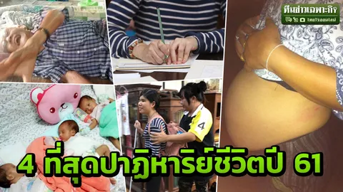 กินยาคุมดันท้อง ตายแล้วฟื้น แยกยื้อชีวิตแฝด3 รวมที่สุดปาฏิหาริย์ปี 61 (คลิป)