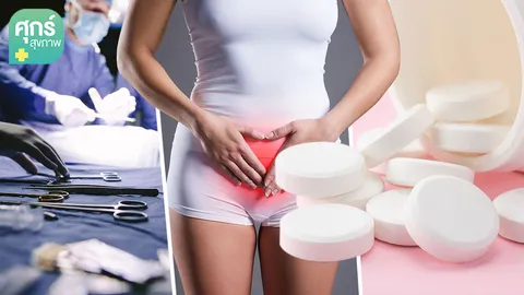 “เยื่อบุโพรงมดลูกเจริญผิดที่” เรื่องน่ารู้สำหรับผู้หญิงทุกคน (ตอน 3)